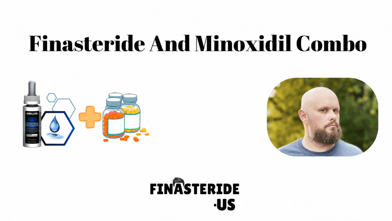 finasteride minoxidil combo